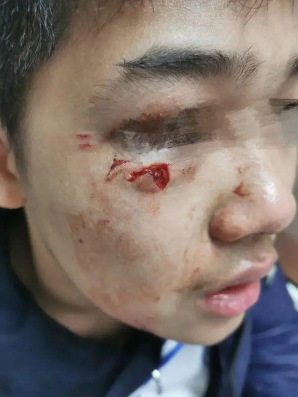 “开门杀”撞伤学生的逃逸男子已被北京警方查获(图2)